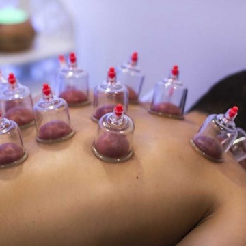 Image for Dry Cupping - 75 Mins.